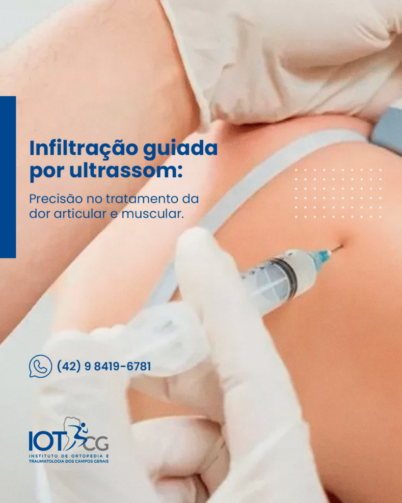 IOT — peça 4